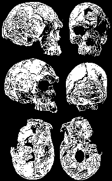 3-part assemblage of herto-man skull